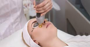 Laser Treatments
